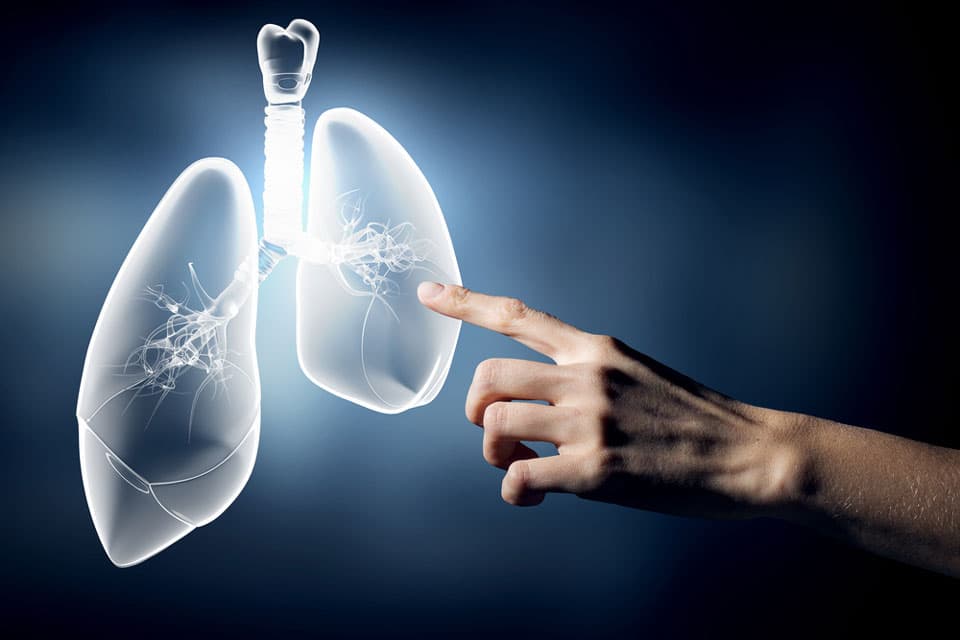 Lung Cancer